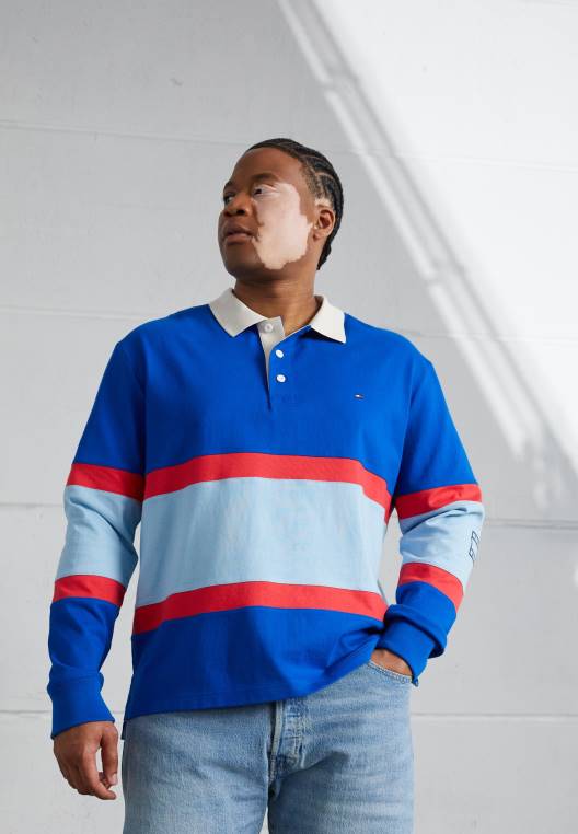 חולצת פולו רוגבי NX205099 אי יווני כחול/רב Tommy Hilfiger